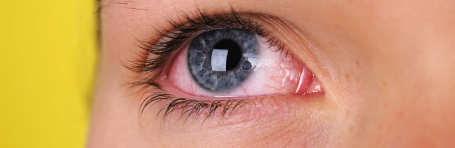 Bacterial Eye Infection Therapeutics Market Growing Demand and Huge Future Opportunities by 2033 Cover Image