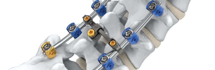 Spine Fixation Market With Manufacturing Process and CAGR Forecast by 2030 Cover Image