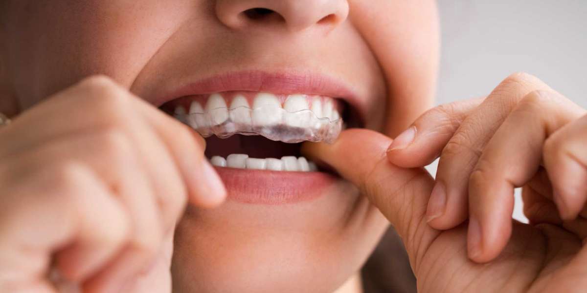 Clear Aligner Therapy Market size See Incredible Growth during 2033