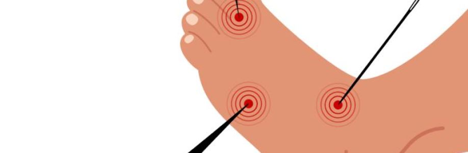 Diabetic Peripheral Neuropathy Treatment Market to Experience Significant Growth by 2030 Cover Image