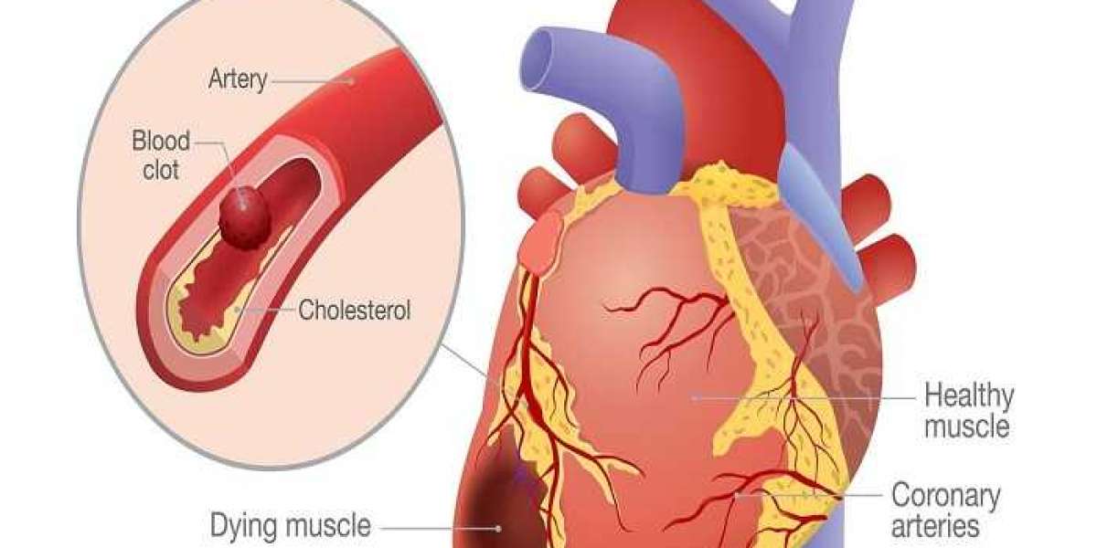 What are the symptoms of heart disease?