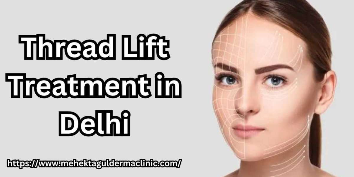 What are the Benefits of Thread Lifts?