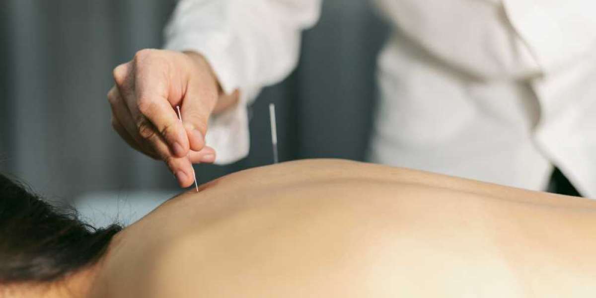 Holistic Healing With Acupuncture In Morristown